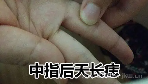 中指长痣代表什么