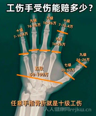 伤残鉴定的结论一般有哪些？