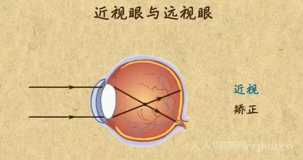 眼视光医学和眼视光学的区别