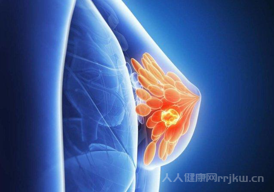 乳腺癌晚期怎么治疗