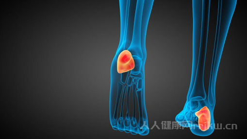 静脉曲张前期能恢复吗