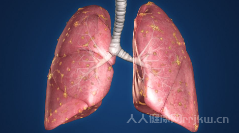 肺不好早期10个征兆