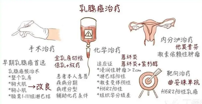 乳腺癌是怎样引起的